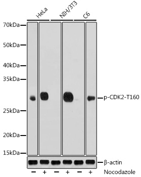 Anti-Phospho-CDK2-T160 Antibody (CABP0325)