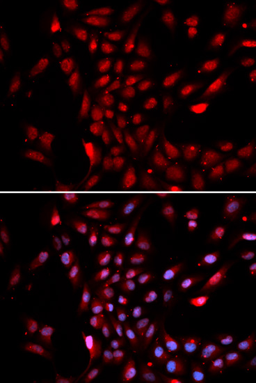 Anti-KPNA4 Antibody (CAB2026)