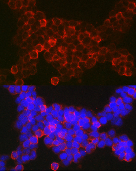 Anti-NFATC2 Antibody (CAB3107)