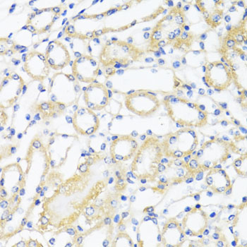 Anti-CTGF Antibody (CAB11067)