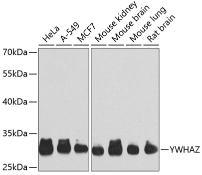 Anti-YWHAZ Antibody (CAB7639)