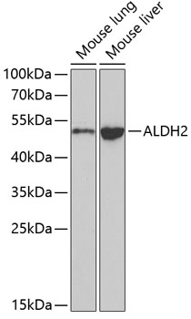 Anti-ALDH2 Antibody (CAB1226)