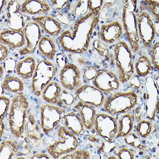 Anti-Ataxin 3 Antibody (CAB1243)