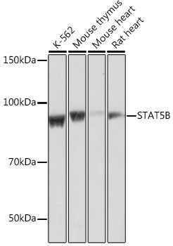 Anti-STAT5B Antibody [KO Validated] (CAB19567)