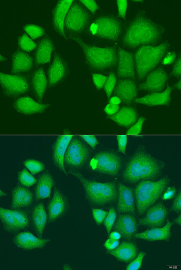 Anti-CAPN2 Antibody [KO Validated] (CAB1861)