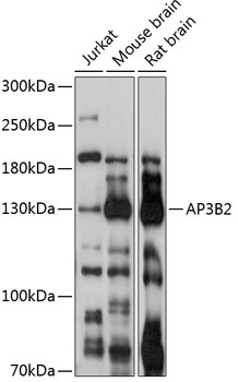 Anti-AP3B2 Antibody (CAB13808)