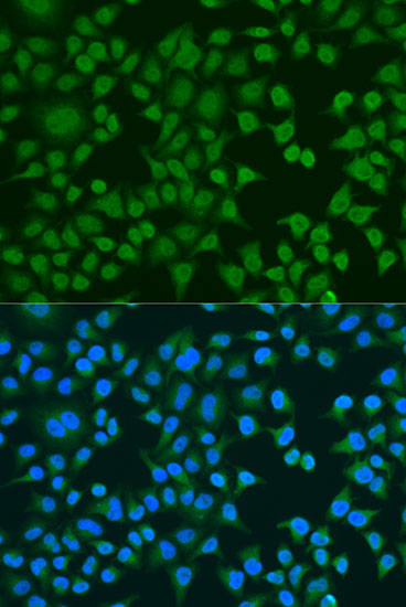 Anti-ELAVL2 Antibody (CAB5918)