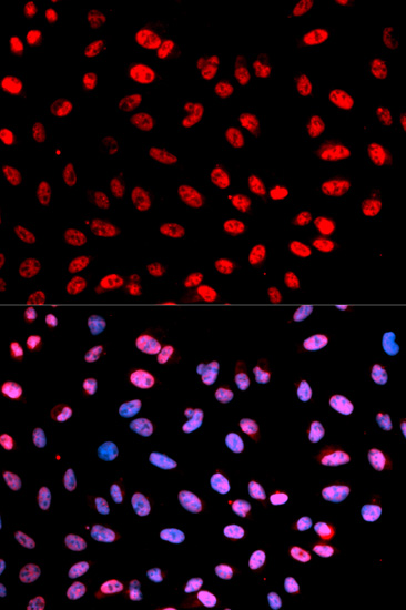 Anti-Separin Antibody (CABP0469)