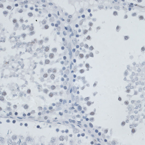 Anti-MSH6 Antibody (CAB16381)