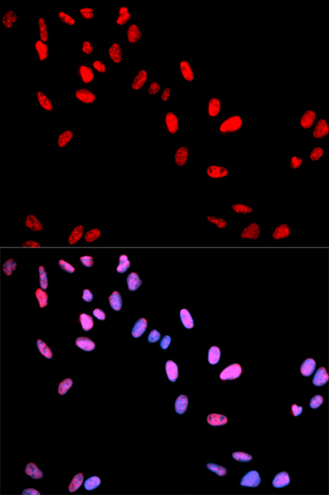 Anti-Phospho-MYC-T58 Antibody (CABP0080)