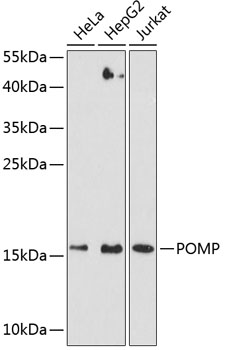 Anti-POMP Polyclonal Antibody (CAB9067)