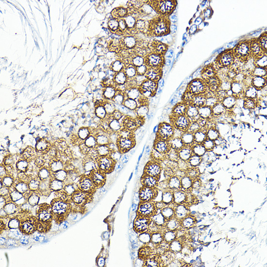 Anti-CALM1 Antibody (CAB14711)