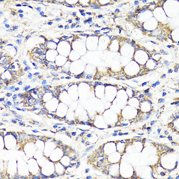 Anti-TGFB1 Antibody (CAB16640)