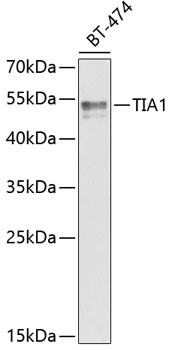 Anti-TIA1 Antibody (CAB6237)