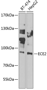 Anti-ECE2 Antibody (CAB7049)