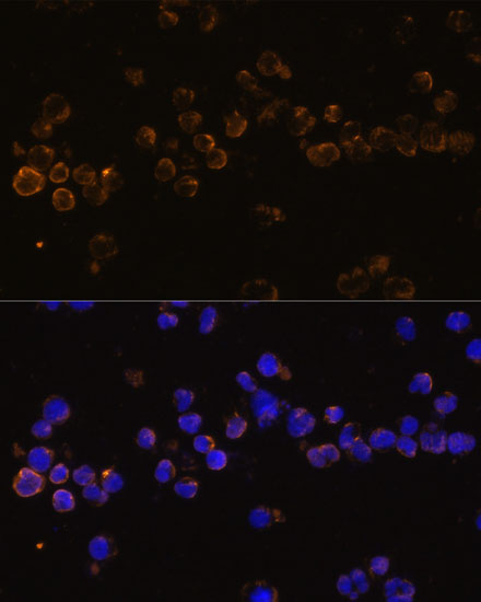 Anti-KLRC4 Antibody (CAB14807)