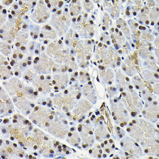 Anti-JNK1 Antibody (CAB0288)