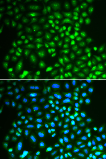 Anti-IFIH1 Antibody (CAB13645)