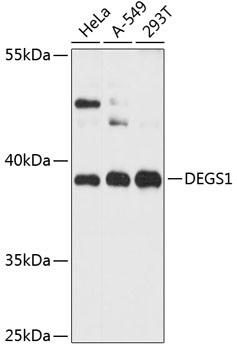 Anti-DEGS1 Antibody (CAB12648)