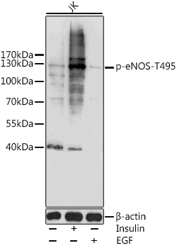 Anti-Phospho-eNOS-T495 Antibody (CABP0516)