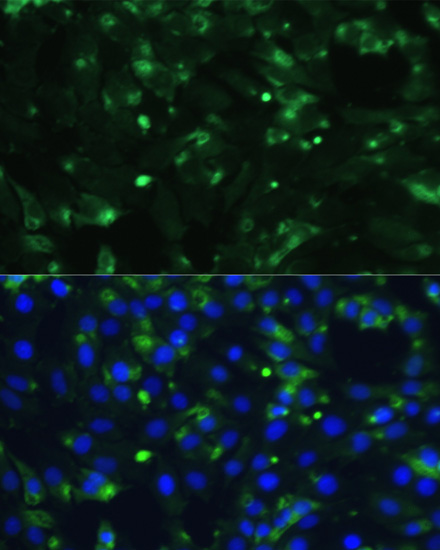 Anti-ENO1 Antibody (CAB16841)