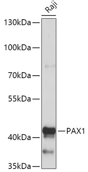 Anti-PAX1 Antibody (CAB17513)