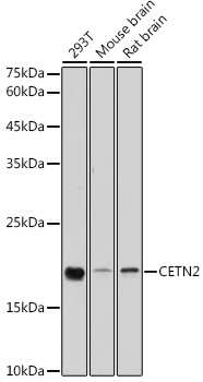 Anti-CETN2 Antibody [KO Validated] (CAB5397)