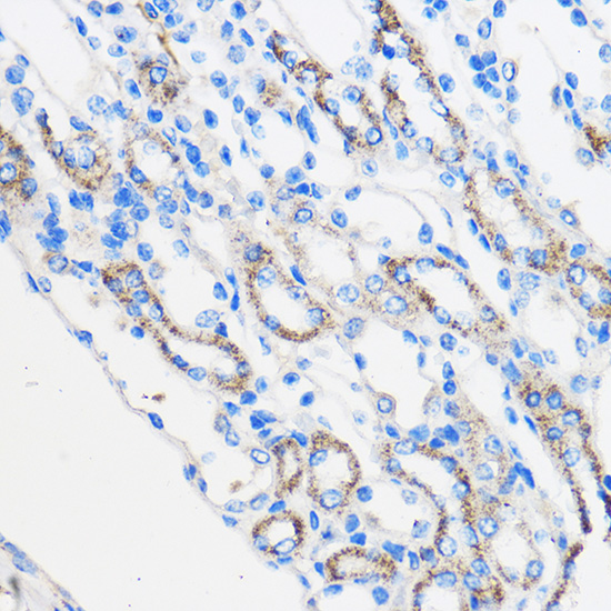 Anti-RARRES2 Antibody (CAB6963)
