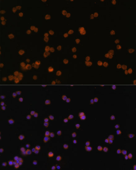 Anti-JAK3 Antibody (CAB0748)