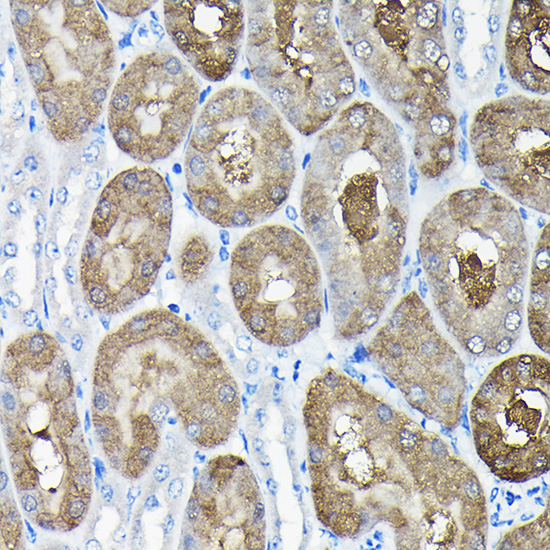 Anti-TCP1 Antibody (CAB13364)