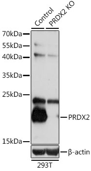 Anti-PRDX2 Antibody [KO Validated] (CAB1919)