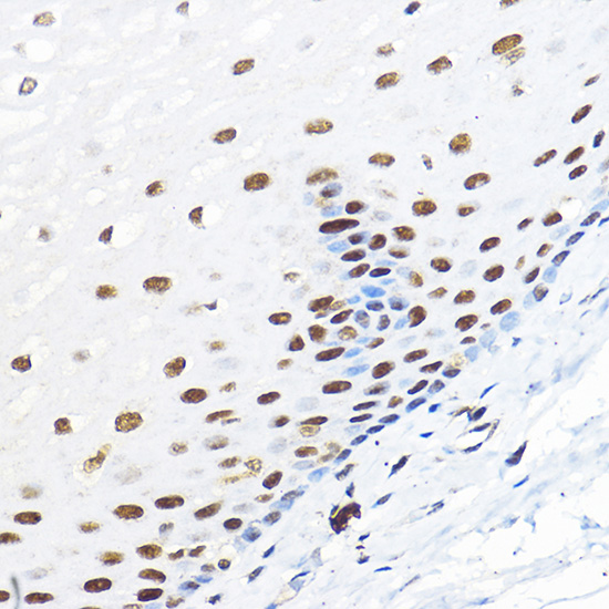 Anti-GTF2B Antibody (CAB1708)