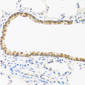 Anti-CDKN2C/p18-INK4C Antibody (CAB2042)