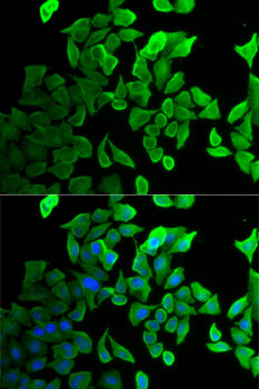 Anti-SEPT2 Antibody (CAB5801)