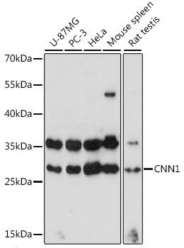 Anti-CNN1 Antibody (CAB16638)