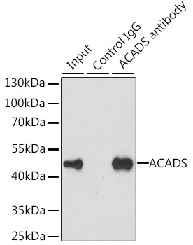 Anti-ACADS Antibody (CAB7230)