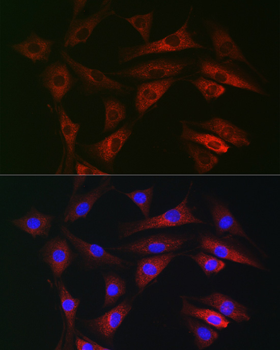 Anti-RAB1B Antibody (CAB7514)