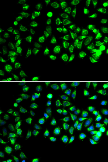 Anti-C16orf80 Antibody (CAB7099)