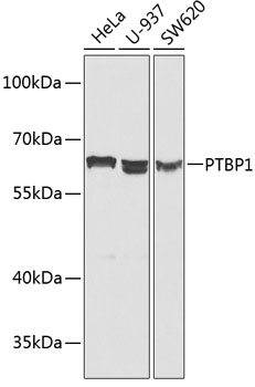 Anti-PTBP1 Antibody (CAB1831)