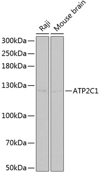 Anti-ATP2C1 Antibody (CAB2515)