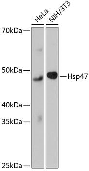 Anti-Hsp47 Antibody