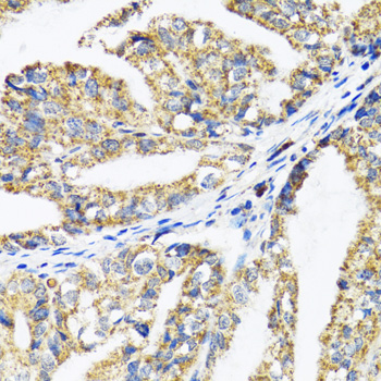 Anti-EPB41 Antibody (CAB2490)