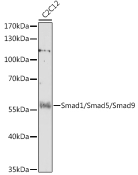 Anti-Smad1/Smad5/Smad9 Antibody (CAB17439)