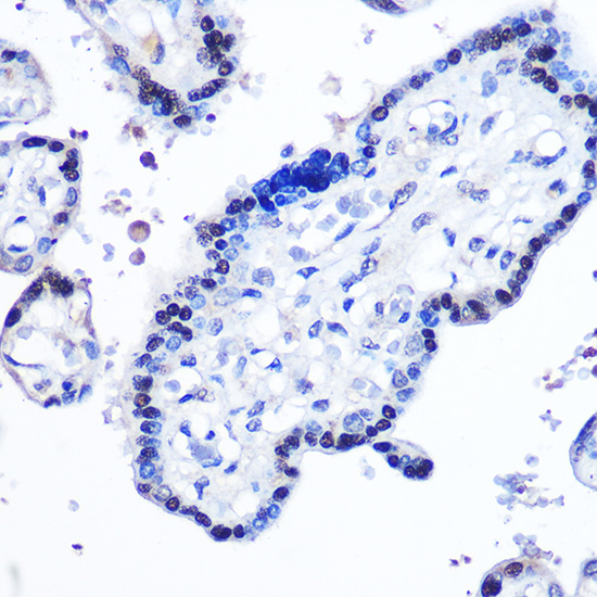 Anti-STAT5B Antibody (CAB12356)