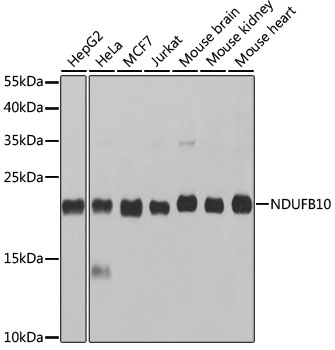 Anti-NDUFB10 Antibody (CAB3982)