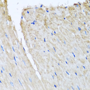 Anti-TTLL12 Polyclonal Antibody (CAB8197)