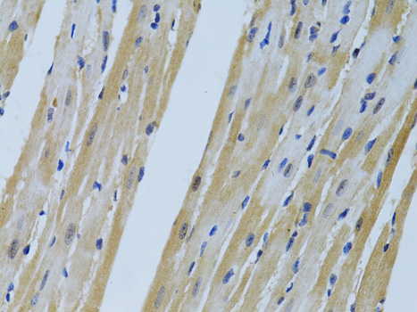 Anti-FHL2 Antibody (CAB1907)