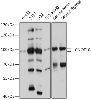 Anti-CNOT10 Antibody (CAB12164)