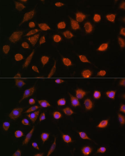 Anti-MCU Antibody (CAB16281)