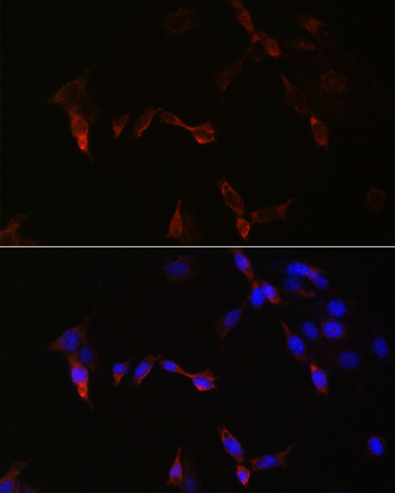 Anti-PLA2G5 Antibody (CAB16711)